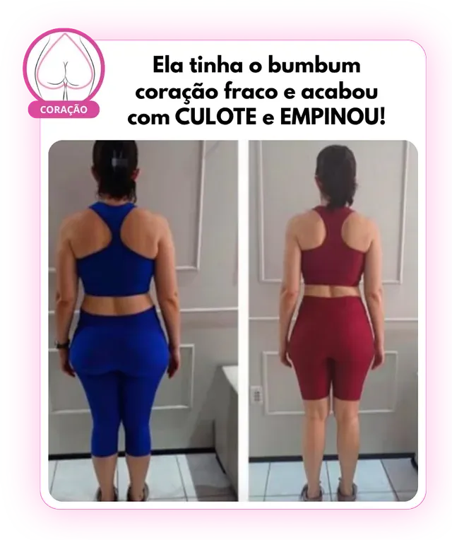 Antes e depois: bumbum coração fraco que acabou com o culote e empinou