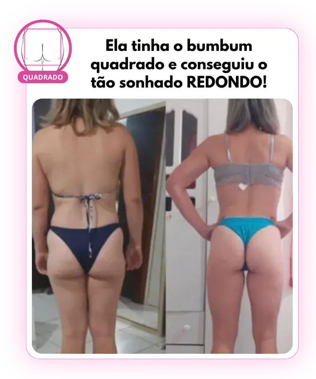Antes e depois: bumbum quadrado que ficou redondo