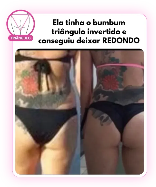 Antes e depois: bumbum triângulo invertido que ficou redondo